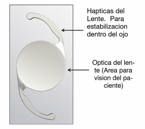 LENTES INTRAOCULARES ESFERICOS