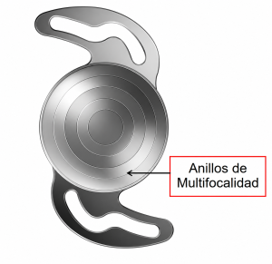 LENTES MULTIFOCALES